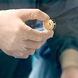 Transcatheter Aortic Valve Replacement